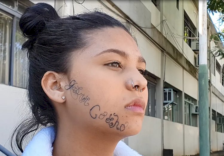 É possível remover tatuagem do rosto? Processo é lento e pode deixar cicatriz; entenda